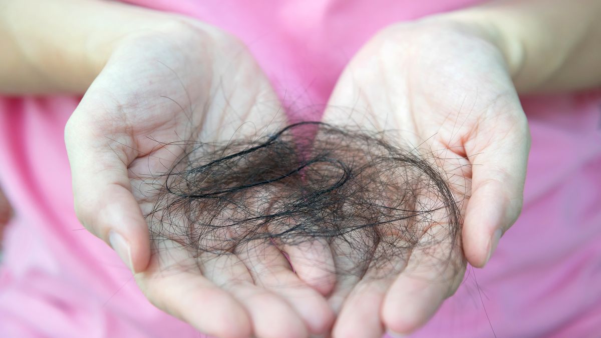 Turkish Hairlines. Pro nové vlasy se nejčastěji létá do Turecka